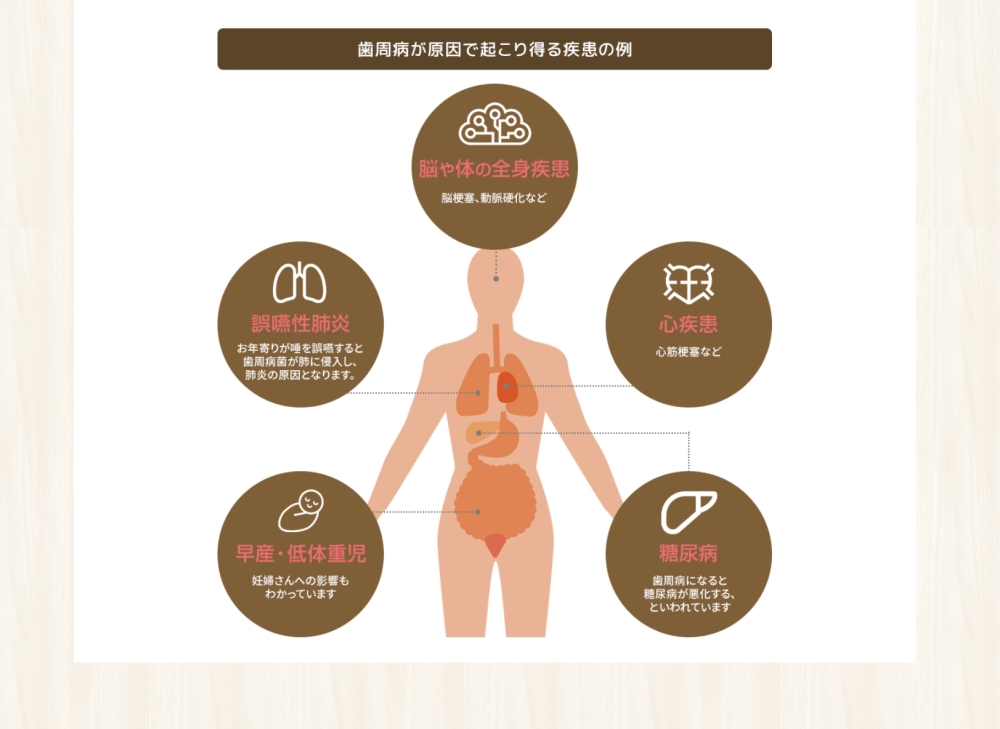 歯周病と全身疾患の関係性